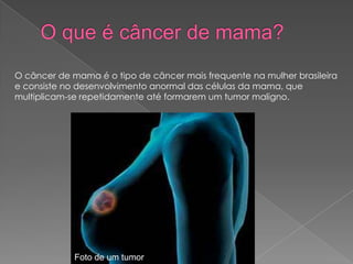 O câncer de mama é o tipo de câncer mais frequente na mulher brasileira
e consiste no desenvolvimento anormal das células da mama, que
multiplicam-se repetidamente até formarem um tumor maligno.
Foto de um tumor
 