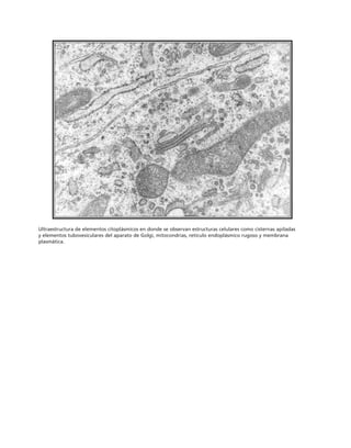 Ultraestructura de elementos citoplásmicos en donde se observan estructuras celulares como cisternas apiladas
y elementos tubovesiculares del aparato de Golgi, mitocondrias, retículo endoplásmico rugoso y membrana
plasmática.
 