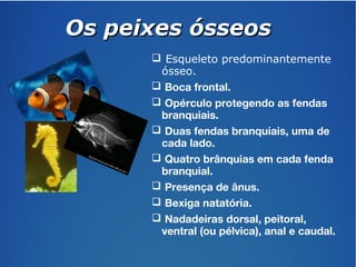 OOss ppeeiixxeess óósssseeooss 
 Esqueleto predominantemente 
ósseo. 
 Boca frontal. 
 Opérculo protegendo as fendas 
branquiais. 
 Duas fendas branquiais, uma de 
cada lado. 
 Quatro brânquias em cada fenda 
branquial. 
 Presença de ânus. 
 Bexiga natatória. 
 Nadadeiras dorsal, peitoral, 
ventral (ou pélvica), anal e caudal. 
 