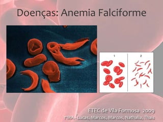 Plaquetas e Coagulação