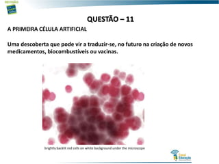 QUESTÃO – 11
A PRIMEIRA CÉLULA ARTIFICIAL
Uma descoberta que pode vir a traduzir-se, no futuro na criação de novos
medicamentos, biocombustíveis ou vacinas.
brightly backlit red cells on white background under the microscope
 