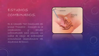 ESTUDIOS 
COMBINADOS. 
Es el llamado Test Combinado del 
primer Trimestre . Consiste en la 
combinación y estudio 
informatizado para calcular un 
índice de riesgo de enfermedad 
cromosómica (especialmente del 
Síndrome de Down). 
 