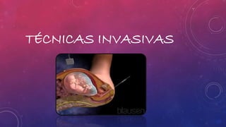 TÉCNICAS INVASIVAS 
 