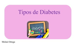 Tipos de Diabetes
Melani Ortega
 