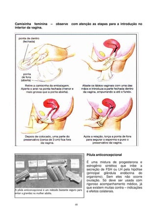 48
Camisinha feminina – observe com atenção as etapas para a introdução no
interior da vagina.
Pílula anticoncepcional
É uma mistura de progesterona e
estrogênio sintético que inibe a
secreção de FSH ou LH pela hipófise
(principal glândula endócrina do
organismo). Sem eles não ocorre
ovulação. Só deve ser usada com
rigoroso acompanhamento médico, já
que existem muitas contra – indicações
e efeitos colaterais.
 