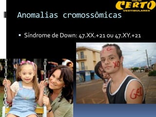 Anomalias cromossômicas

 Síndrome de Down: 47.XX.+21 ou 47.XY.+21
 