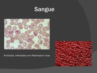 Sangue Eritrócitos, infectados com  Plasmodium vivax 