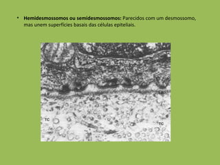 Hemidesmossomos ou semidesmossomos:  Parecidos com um desmossomo, mas unem superfícies basais das células epiteliais. 