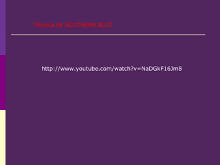 http://www.youtube.com/watch?v=NaDGkF16Jm8
Técnica de SOUTHERN BLOT
 