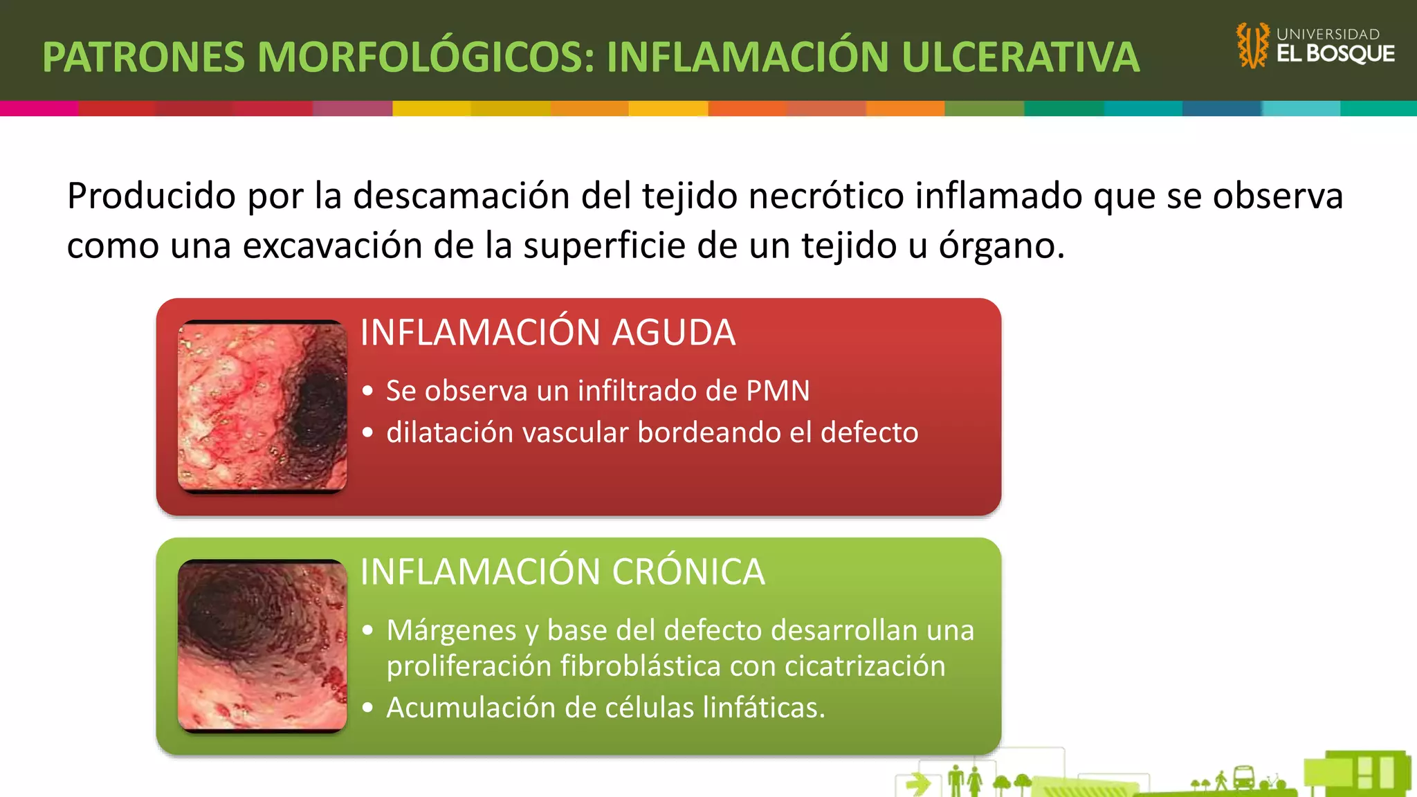 Fisiopatologia y Biologia de la inflamación | PPTX