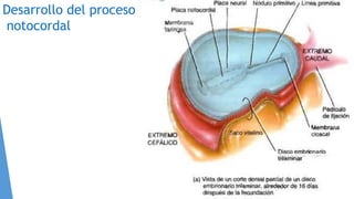 Desarrollo del proceso
notocordal
 