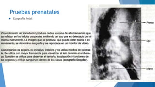 Pruebas prenatales
 Ecografía fetal
 