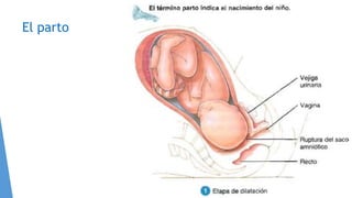 El parto
 