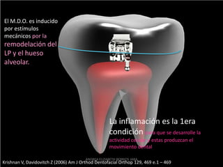 El M.D.O. es inducido
por estímulos
mecánicos por la
remodelación del
LP y el hueso
alveolar.




                                                     La inflamación es la 1era
                                                     condición para que se desarrolle la
                                                     actividad celular y estas produzcan el
                                                     movimiento dental

                                        ANDREA ELIZABETH BERRIOS JARA
Krishnan V, Davidovitch Z (2006) Am J Orthod Dentofacial Orthop 129, 469 e.1 – 469
 