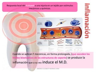 Respuesta local del huésped a una injuria en un tejido por estímulos
                       mecánicos y químicos.




      Cuando se aplican F mecánicas, en forma prolongada, (que exceden los
      límites bioelasticos de las estructuras de soporte) se produce la
      inflamación que a su vez induce                el M.D.
                              ANDREA ELIZABETH BERRIOS JARA
 
