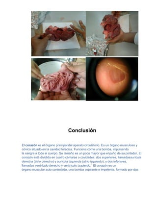 Conclusión

El corazón es el órgano principal del aparato circulatorio. Es un órgano musculoso y
cónico situado en la cavidad torácica. Funciona como una bomba, impulsando
la sangre a todo el cuerpo. Su tamaño es un poco mayor que el puño de su portador. El
corazón está dividido en cuatro cámaras o cavidades: dos superiores, llamadasaurícula
derecha (atrio derecho) y aurícula izquierda (atrio izquierdo), y dos inferiores,
llamadas ventrículo derecho y ventrículo izquierdo.1 El corazón es un
órgano muscular auto controlado, una bomba aspirante e impelente, formado por dos
 