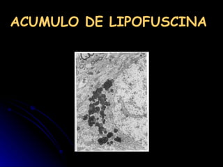ACUMULO DE LIPOFUSCINA   