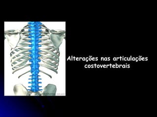 Alterações nas articulações costovertebrais 