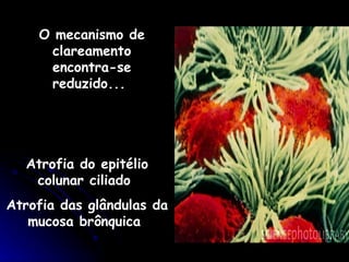 O mecanismo de clareamento encontra-se reduzido...   Atrofia do epitélio colunar ciliado  Atrofia das glândulas da mucosa brônquica   