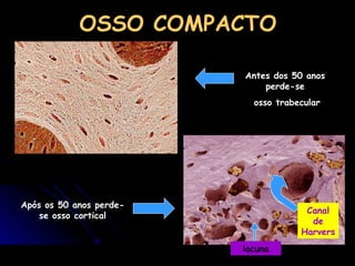 OSSO COMPACTO Após os 50 anos perde-se osso cortical Canal de Harvers lacuna Antes dos 50 anos perde-se osso trabecular 