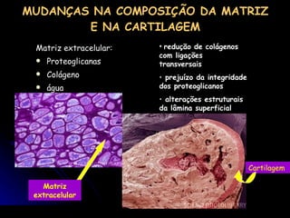 Matriz extracelular: Proteoglicanas Colágeno  água MUDANÇAS NA COMPOSIÇÃO DA MATRIZ E NA CARTILAGEM redução de colágenos com ligações transversais prejuízo da integridade dos proteoglicanos  alterações estruturais da lâmina superficial  Matriz extracelular condrócito Cartilagem  