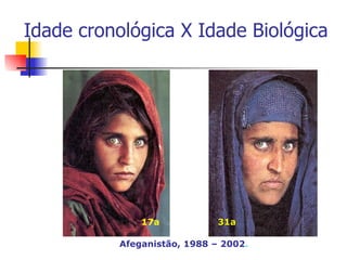 Idade cronológica X Idade Biológica 17a 31a Afeganistão, 1988 – 2002 . 
