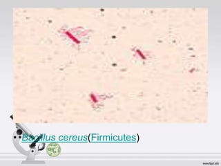 • Bacillus cereus(Firmicutes)
 