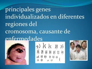 principales genes
individualizados en diferentes
regiones del
cromosoma, causante de
enfermedades

 