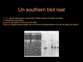 Un southern blot real
1 a 11: clones bacterianos conteniendo distintos genes de interés clonados
L: marcadores de tamaño
Izquierda: gel teñido con bromuro de etidio
Derecha: southern blot revelado con una sonda correspondiente a uno de los genes de interés
 