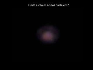 Onde estão os ácidos nucléicos?
 