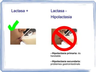 Lactasa + Lactasa - Hipolactasia  - Hipolactasia primaria:  és heretable - Hipolactasia secundaria:  problemes gastrointestinals 