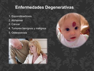 Enfermedades Degenerativas:
1. Espondiloartrosis.
2. Alzheimer
3. Cáncer
4. Tumores benignos y malignos
5. Osteoporosis
 