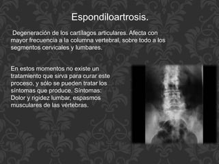 Degeneración de los cartílagos articulares. Afecta con
mayor frecuencia a la columna vertebral, sobre todo a los
segmentos cervicales y lumbares.
Espondiloartrosis.
En estos momentos no existe un
tratamiento que sirva para curar este
proceso, y sólo se pueden tratar los
síntomas que produce. Síntomas:
Dolor y rigidez lumbar, espasmos
musculares de las vértebras.
 