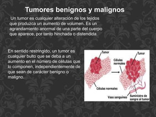 Tumores benignos y malignos
Un tumor es cualquier alteración de los tejidos
que produzca un aumento de volumen. Es un
agrandamiento anormal de una parte del cuerpo
que aparece, por tanto hinchada o distendida.
En sentido restringido, un tumor es
cualquier bulto que se deba a un
aumento en el número de células que
lo componen, independientemente de
que sean de carácter benigno o
maligno.
 
