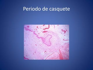 Periodo de casquete  