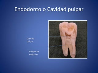 Endodonto o Cavidad pulpar 
Cámara 
pulpar 
Conducto 
radicular  