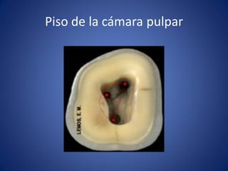 Piso de la cámara pulpar  