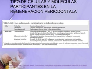 TIPO DE CELULAS Y MOLECULAS
PARTICIPANTES EN LA
REGENERACIÓN PERIODONTALA
P. Bartold, Christopher a. G.mcculloch, a. S. narayanan. S pitaru .Tissue engineering: a new paradigm for periodontal regeneration based on molecular and cell biology
. Periodontology 2000, Vol. 24, 2000, 253–269
 