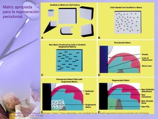Matriz apropiada
para la regeneración
periodontal.
P. Bartold, Christopher a. G.mcculloch, a. S. narayanan. S pitaru .Tissue engineering: a new paradigm for periodontal regeneration based on molecular and cell biology
. Periodontology 2000, Vol. 24, 2000, 253–269
 