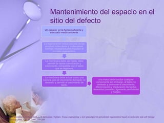 Mantenimiento del espacio en el
sitio del defecto
Un espacio en la herida suficiente y
adecuado medio ambiente
La regeneración actúa cascada de las
pruebas moleculares y moleculares.
eventos necesarios para impulsar el
proceso regenerativo.
La membrana debe ser rígida, debe
permitir la rápida colonización y
crecimiento, compatible con el tejido
que se regenera.
La menbrana debe actuar como una
barrera para el crecimiento del tejido no
deseado y permitir el crecimiento de
tejido.
una matriz debe excluir cualquier
componente sin embargo, el tejido no
deseado y promover el crecimiento,
diferenciación y maduración de tejidos
deseados (cemento, ligamento periodontal
y hueso).
P. Bartold, Christopher a. G.mcculloch, a. S. narayanan. S pitaru .Tissue engineering: a new paradigm for periodontal regeneration based on molecular and cell biology
. Periodontology 2000, Vol. 24, 2000, 253–269
 