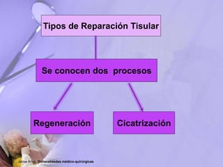 Tipos de Reparación Tisular
Se conocen dos procesos
Regeneración Cicatrización
Jaime Arias. Generalidades médico-quirúrgicas
 