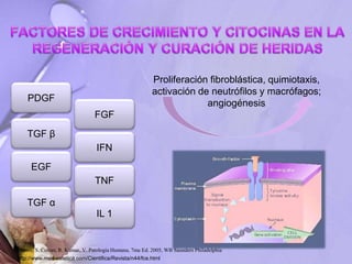 FGF
TNF
IL 1
EGF
TGF α
TGF β
PDGF
IFN
Proliferación fibroblástica, quimiotaxis,
activación de neutrófilos y macrófagos;
angiogénesis
Robbins, S. Cotran, R. Kumar, V. Patología Humana, 7ma Ed. 2005, WB Saunders Philadelphia
http://www.med-estetica.com/Cientifica/Revista/n44/fce.html
 