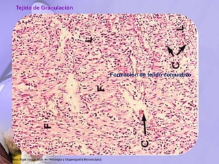 Formación de tejido conjuntivo
Tejido de Granulación
Jesús Boya Vegue Atlas de Histología y Organografía Microscópica
 