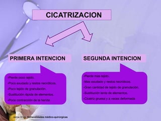 CICATRIZACION
PRIMERA INTENCION SEGUNDA INTENCION
-Pierde poco tejido.
-Poco exudado y restos necróticos.
-Poco tejido de granulación.
-Sustitución rápida de elementos.
-Poca contracción de la herida
-Pierde mas tejido.
-Mas exudado y restos necróticos.
-Gran cantidad de tejido de granulación.
-Sustitución lenta de elementos.
-Cicatriz gruesa y a veces deformada
Jaime Arias. Generalidades médico-quirúrgicas
 