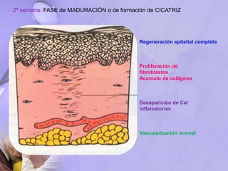 2ª semana: FASE de MADURACIÓN o de formación de CICATRIZ
Regeneración epitelial completa
Proliferación de
fibroblastos
Acumulo de colágeno
Desaparición de Cel
inflamatorias
Vascularización normal
 