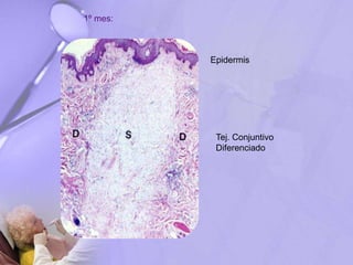 Epidermis
Tej. Conjuntivo
Diferenciado
1º mes:
 