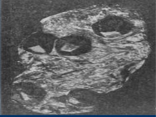 -Inclusiones cristalinas de células vegetales