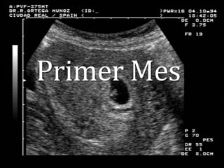 Primer Mes

 