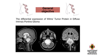 General
objective
The differential expression of Wilms’ Tumor Protein in Diffuse
Intrinsic Pontine Glioma
 