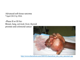 Advanced soft tissue sarcoma
*April 2012 by FDA
-Phase II or III for:
Breast, lung, cervical, liver, thyroid
prostate and colorectal cancer
http://www.charonboat.com/2009/02/charonboat_dot_com_sarcoma1.jpg
 